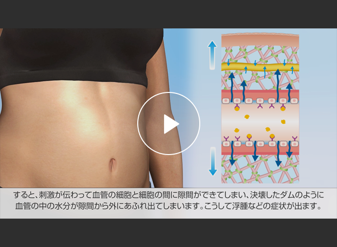 【動画】HAEの発作について